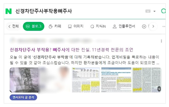 정형외과마케팅, 개원 2달 만에 신환 150명 유치할 수 있었던 이유? 관련 이미지